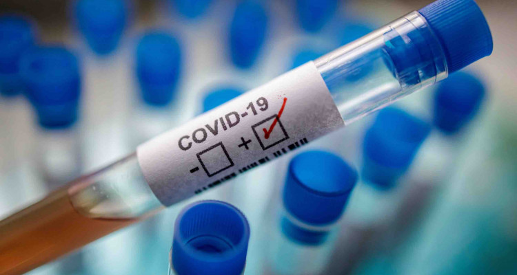 Maroc : 99 nouveaux de coronavirus en 24h