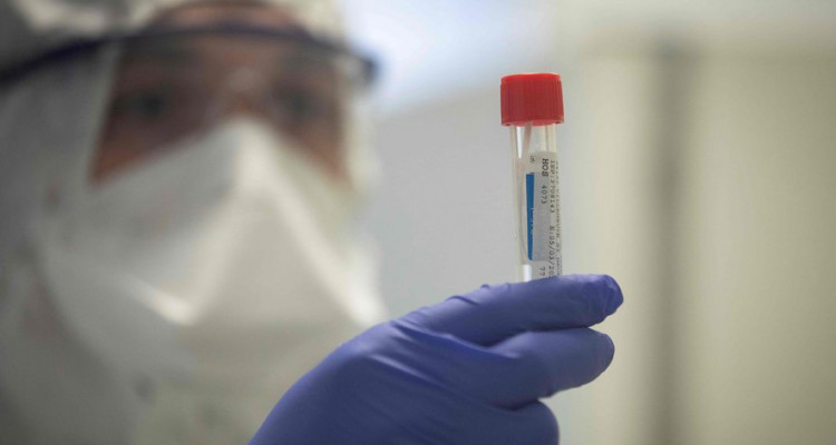 Coronavirus : Bilan dans le monde