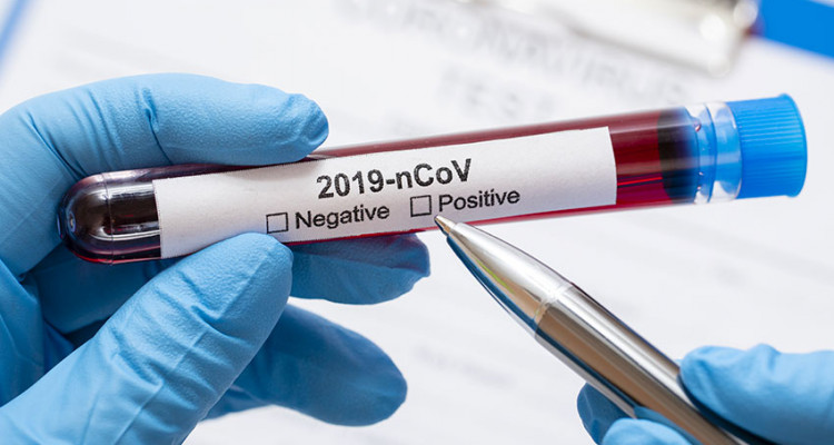 Coronavirus