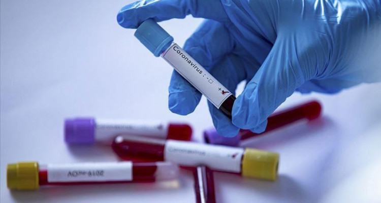 coronavirus