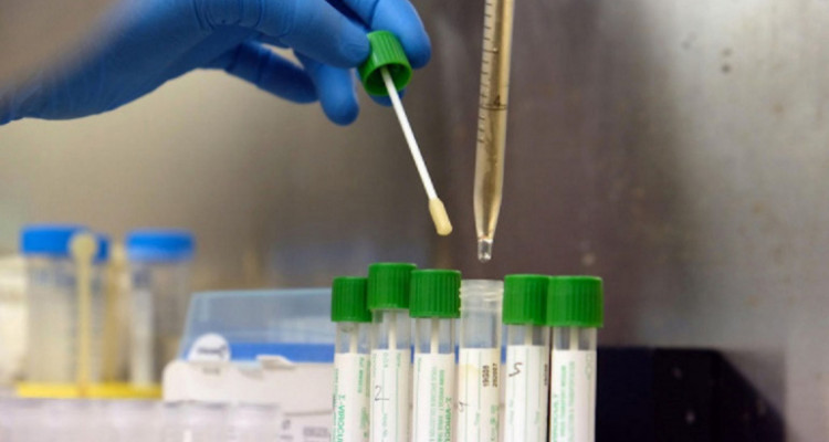 رسمي: الانطلاق في اجراء التحاليل السريعة لكورونا بالمخابروالصيدليات الخاصة