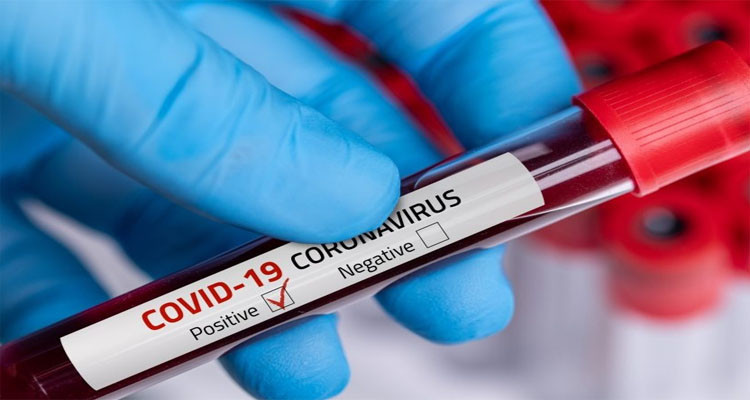 Sidi Bouzid : 17 nouveaux cas de coronavirus