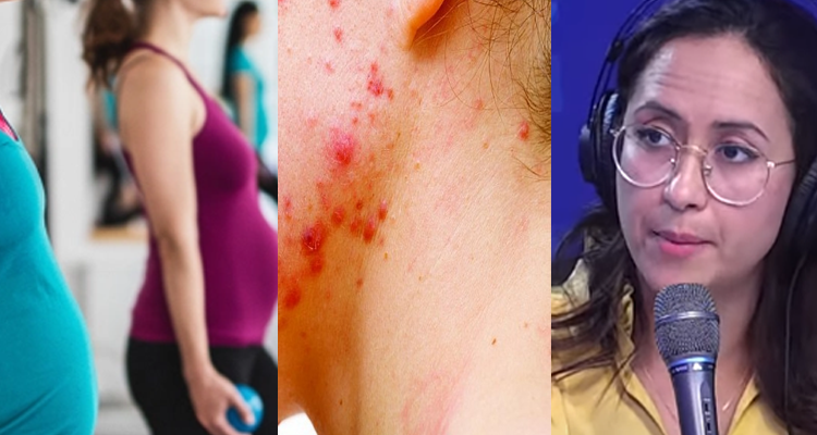 متلازمة تكيس البويضات