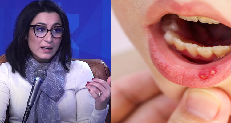 د.نادية يحيى تشكف علاقة الكوفيد بأمراض الفم والأسنان وتدق ناقوس الخطر