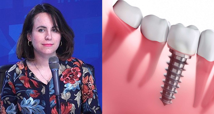 كيف تتم عملية زرع الأسنان وكيف نتفادى فشلها؟