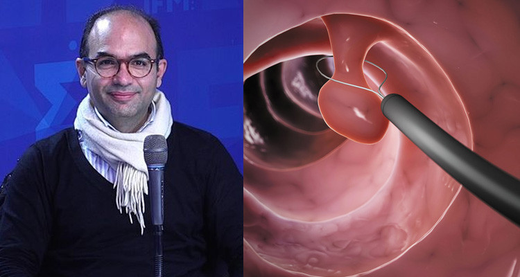 الدكتور أمين مقني: سرطان القولون مرض خطير وهذه طرق الوقاية منه