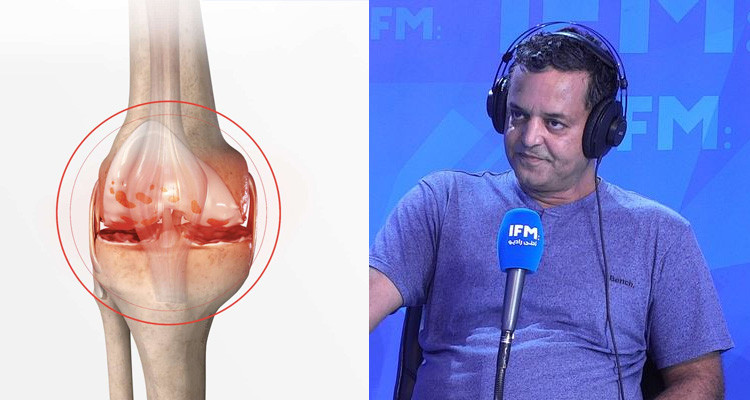 الدكتور نوفل مقداد يكشف أهم طرق علاج التهاب مفصل الركبة