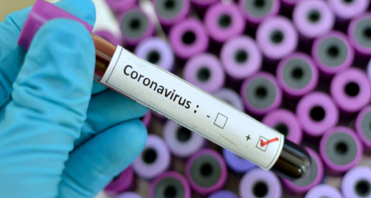 وزارة الصحة: تسجيل 20 حالة وفاة و5511 إصابة جديدة بالكورونا