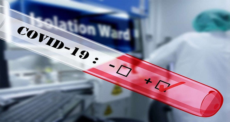 الكاف: تسجيل 03 حالات وفاة و27 إصابة جديدة بالكورونا