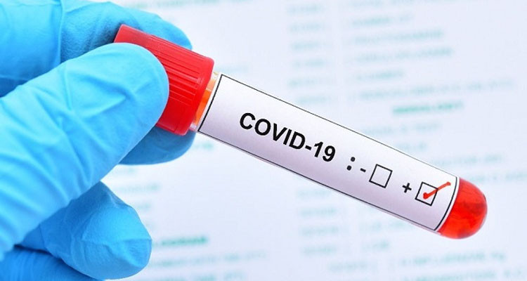 وزارة الصحة: تسجيل 6 وفيات و1013 إصابة جديدة بالكورونا