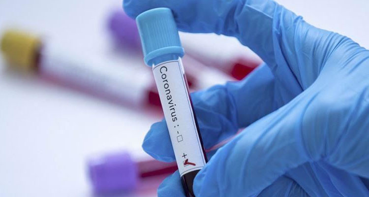 سوسة: تسجيل 410 إصابة جديدة بفيروس كورونا