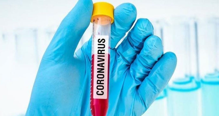 وزارة الصحة: تسجيل 3 وفيات و339 إصابة جديدة بفيروس كورونا