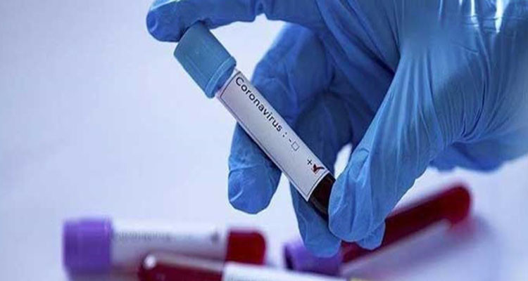 وزارة الصحة: تسجيل 4 وفيات و 182 إصابة جديدة بفيروس كورونا