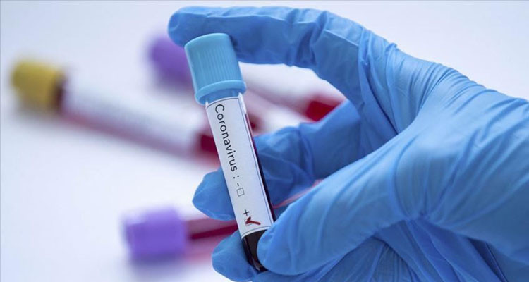 وزارة الصحة: تسجيل 108 إصابة جديدة بفيروس كورونا