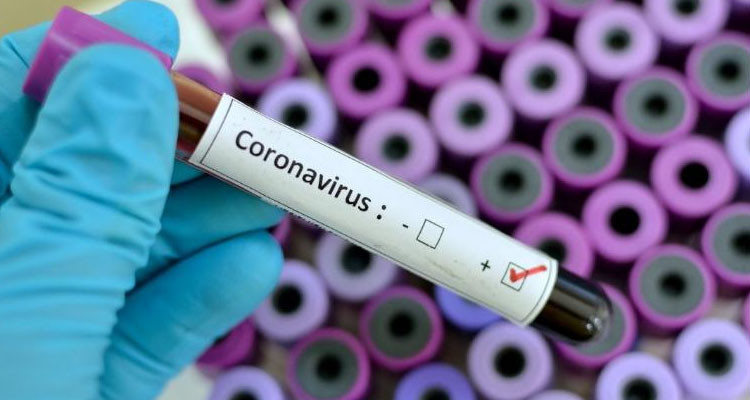 وزارة الصحة: تسجيل 3 حالات وفاة و114 إصابة جديدة بفيروس كورونا