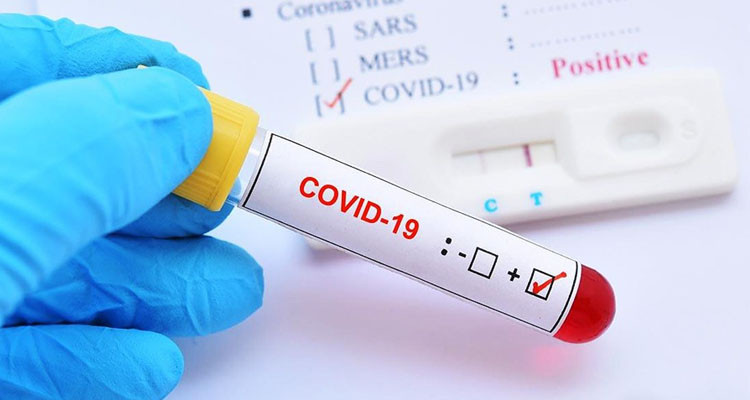 وزارة الصحة: تسجيل 81 إصابة جديدة بكورونا وصفر وفيات