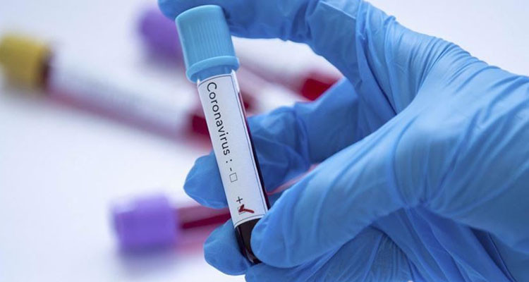 وزارة الصحة: تسجيل حالتي وفاة و109 إصابة جديدة بفيروس كورونا