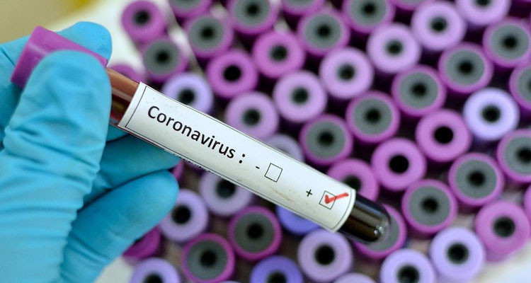 وزارة الصحة: تسجيل حالة وفاة و 441 إصابة جديدة بفيروس كورونا