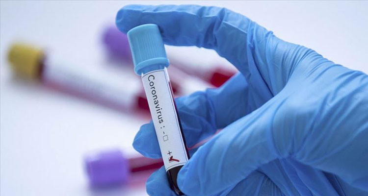 وزارة الصحة: تسجيل 3 وفيات و137 إصابة بفيروس كورونا