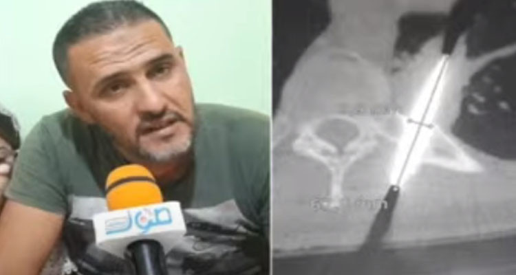 عاش 25 عاما بخنجر مغروز في ظهره: شهادة حصرية من جزائري غيّر طبيب تونسي حياته