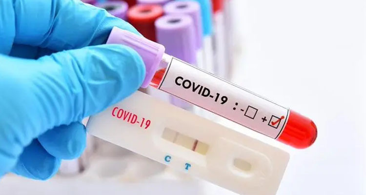 وزارة الصحة تعلن تسجيل حالة وفاة و74 إصابة جديدة بالكورونا