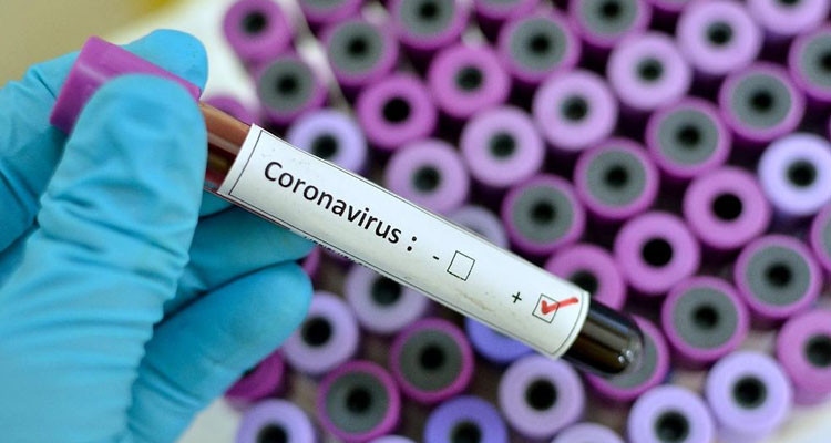 وزارة الصحة: تسجيل 4 حالات وفاة و187 إصابة جديدة بالكورونا