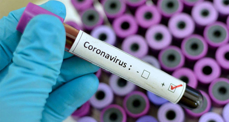 وزارة الصحة: تسجيل 6 وفيات و260 إصابة جديدة بفيروس كورونا