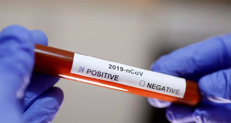 وزارة الصحة: تسجيل 9 وفيات و221 إصابة جديدة بالكورونا