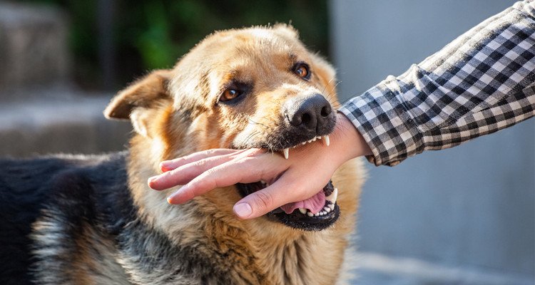 القصرين : تسجيل إصابة بداء الكلب لدى شخص