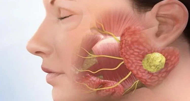 القصرين: تسجيل إصابات بإلتهاب الغدة النكافية في الوسط المدرسي