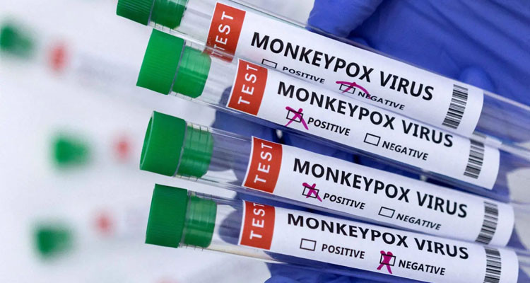 كندا ترصد أول إصابة بسلالة فرعية من جدري القردة