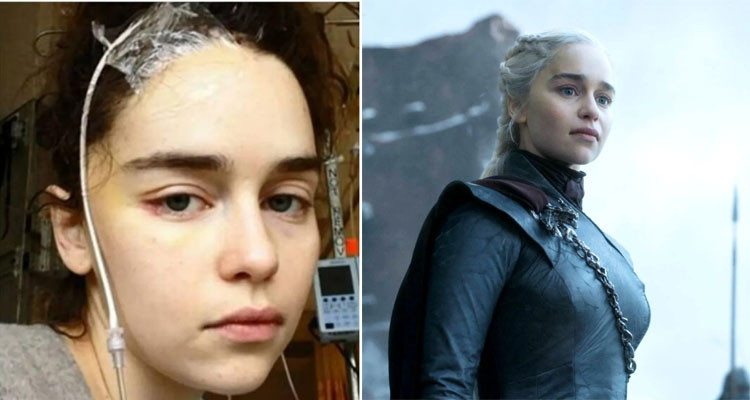 The star of Game of Thrones: "It's remarkable that I am able to speak"