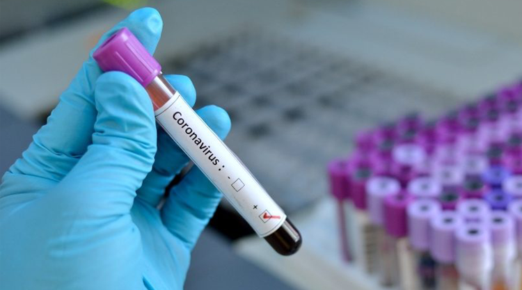 Bilan coronavirus : 442 tests, 32 nouveaux cas 