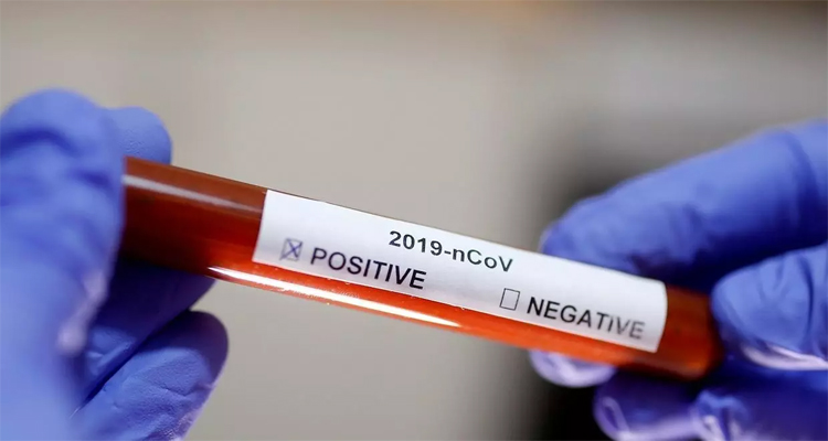 إصابة بالكورونا في باجة