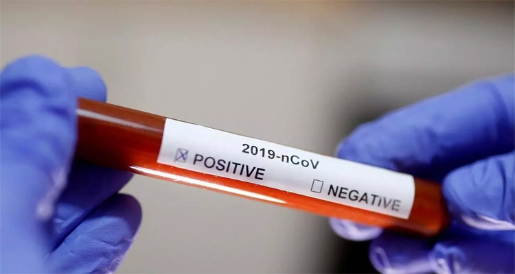 فيروس كورونا