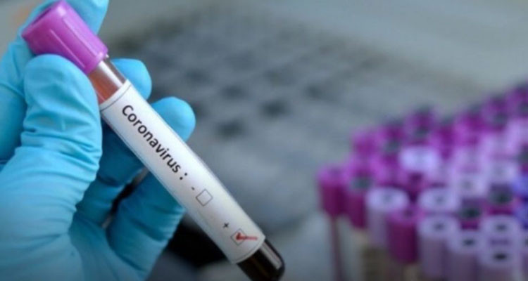 الكاف : 15 إصابة محلّية جديدة بالكورونا