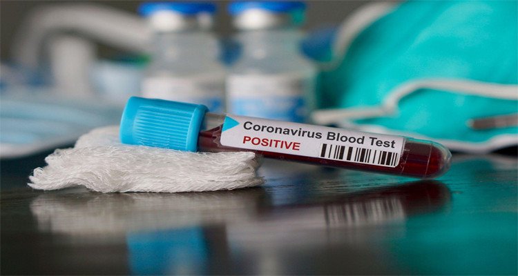 اليوم 06 ولايات تسجل اصابات محلية بفيروس كورونا