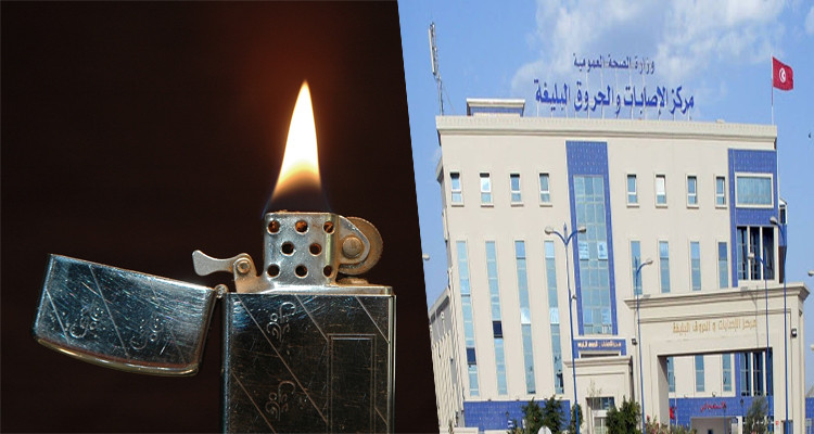 حروق مستشفى