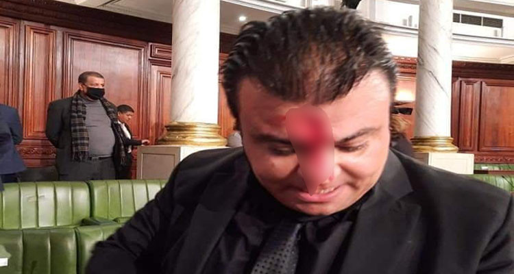 اعتداء على النائب أنور بالشاهدعتداء على انور بالشاهد