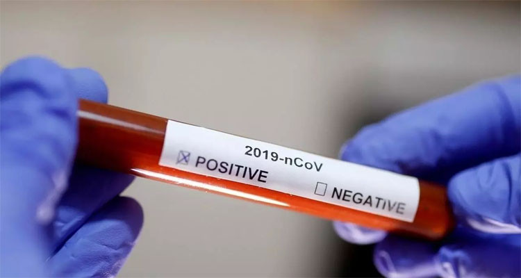 سليانة: 40 إصابة جديدة بفيروس كورونا المستجد