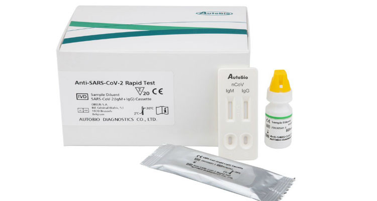 تونس لم تتسلم بعد طلبية الـ200 ألف تحليل سريع