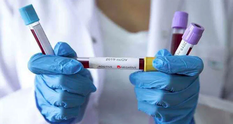 فيروس كورونا: تسجيل عاشر حالة شفاء في بنزرت