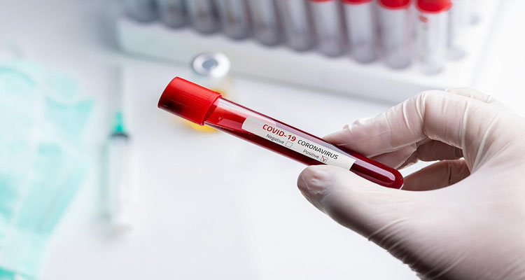 تاسع حالة إصابة بالكورونا في منوبة