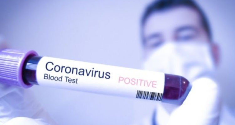 فيروس كورونا: تسجيل 148 حالة شفاء في تونس  