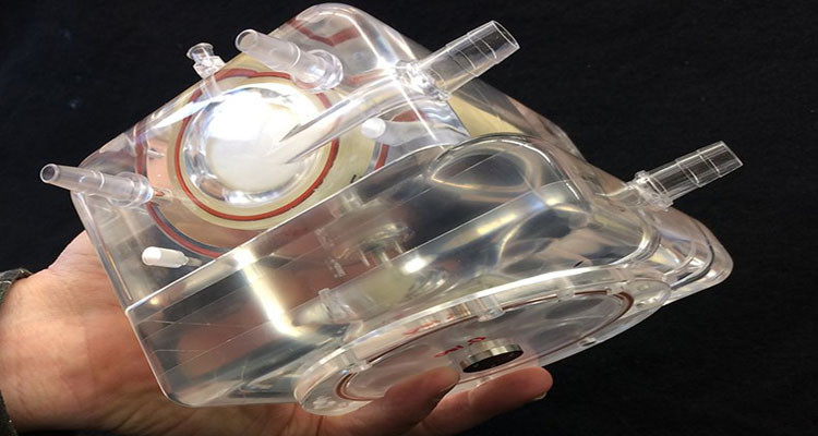 استعمال رئة اصطناعية لإنقاذ مصابة بالكورونا في تونس