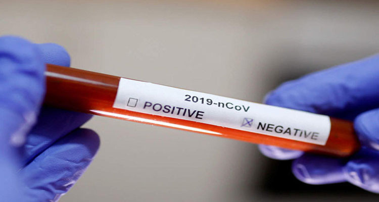 نتائج تحاليل سلبية في باجة