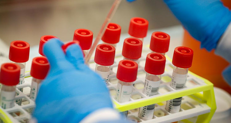 فيروس كورونا: عدم تسجيل إصابات جديدة في صفاقس 