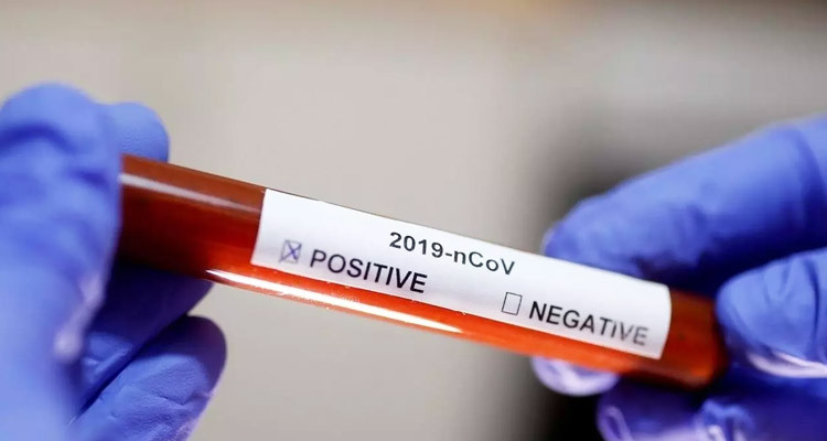 وزارة الصحة تعلن عن تسجيل 4 إصابات جديدة وافدة بفيروس كورونا