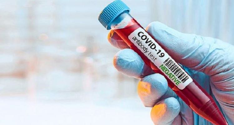 إلزامية الحجر الصحي الإجباري بما في ذلك الأطفال دون 12 سنة