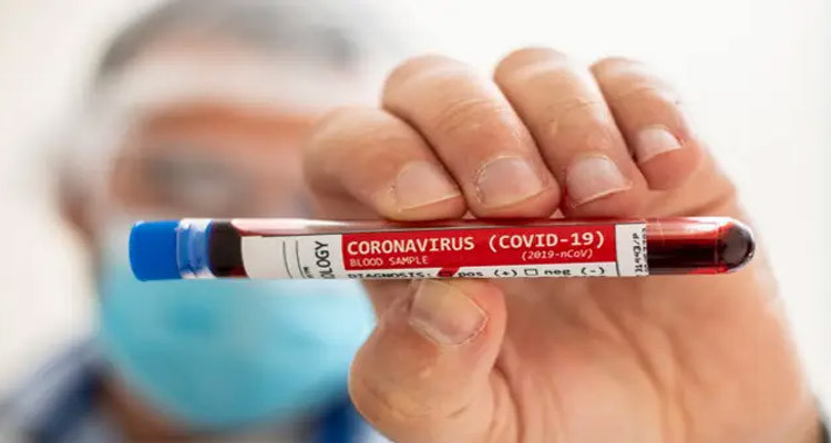 وزارة الصحة تعلن تسجيل 5 حالات إصابة جديدة وافدة بفيروس كورونا